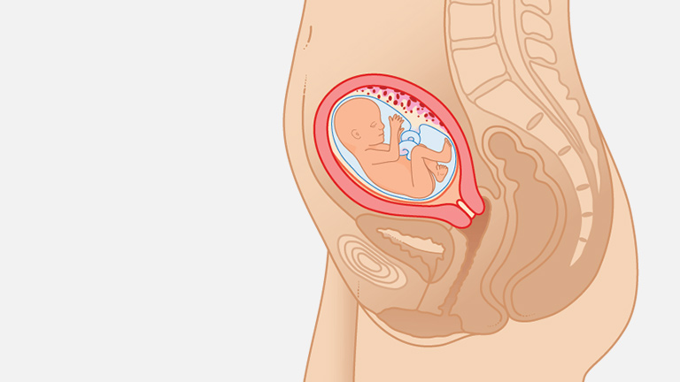 妊娠16週目の超音波検査