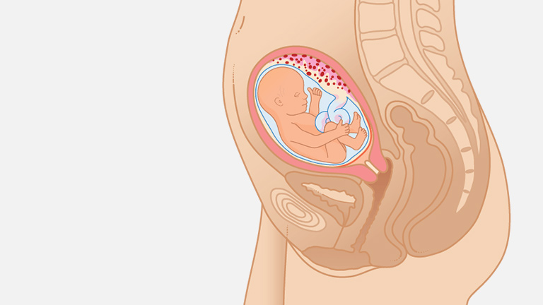 Una ecografía de 18 semanas de embarazo