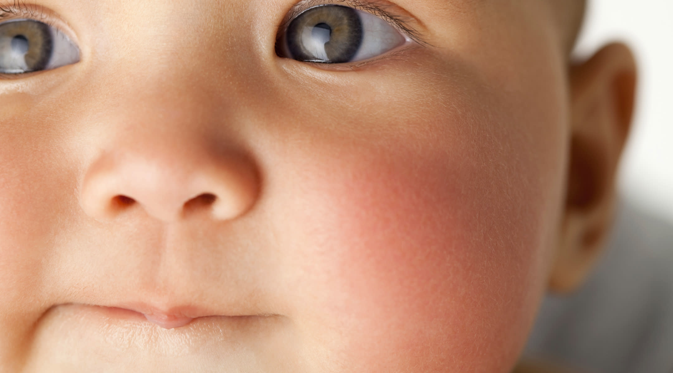 pink eye in infant #10
