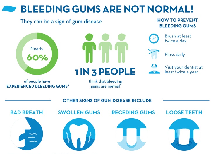 Bleeding Gums Causes Treatments and Prevention