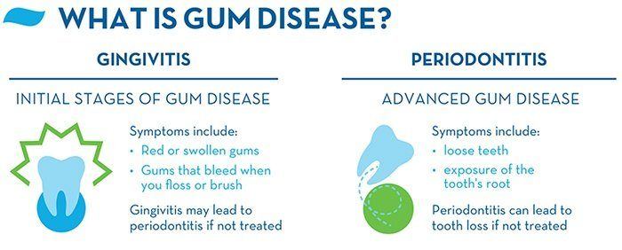 gum-disease-symptoms-causes-02